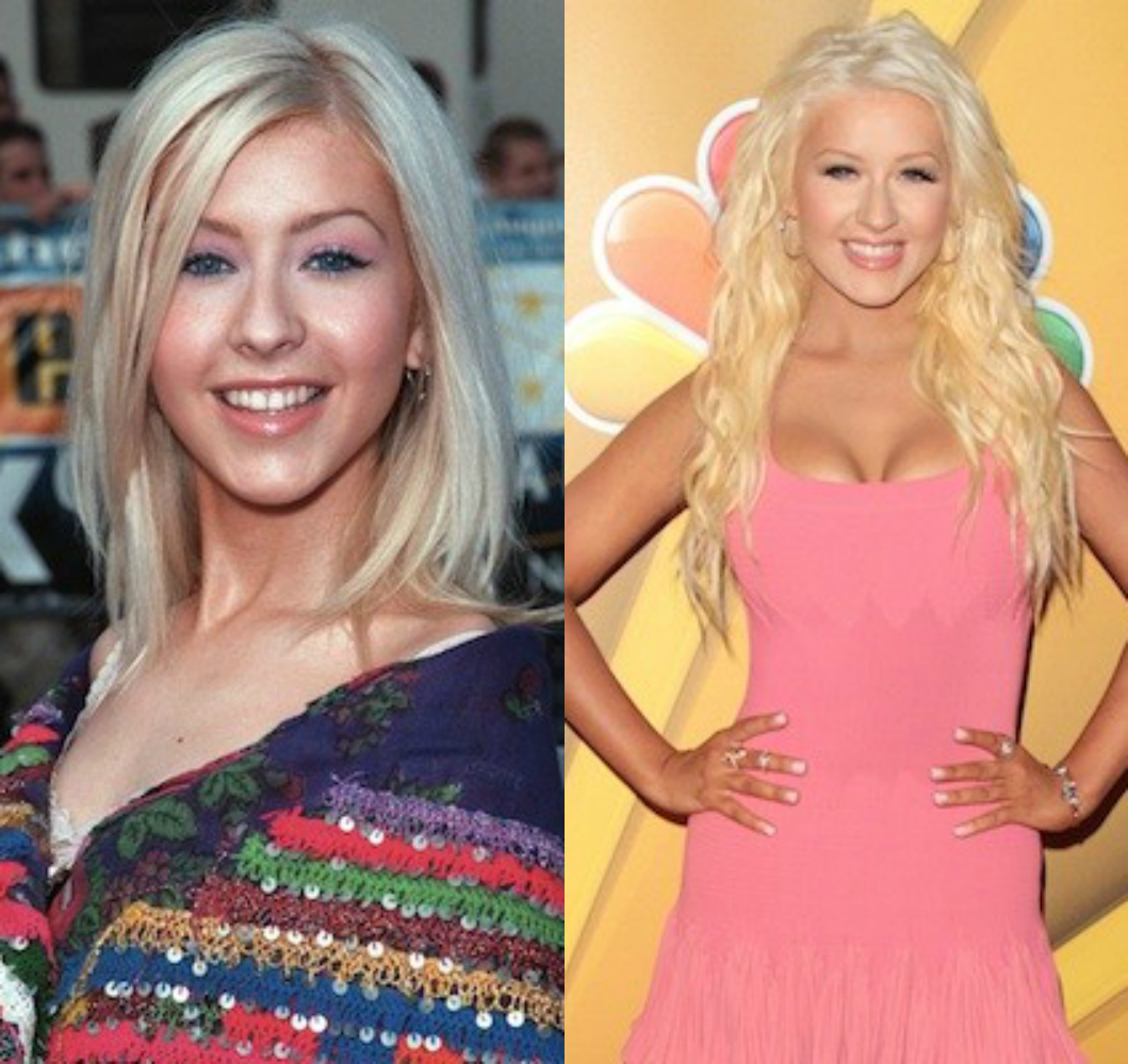 entretenimento | famosas | celebridades | plástica | antes e depois da plástica de algumas famosas | Lana de Rey | Megan Fox | Lindsay Lohan | Christina Aguilera