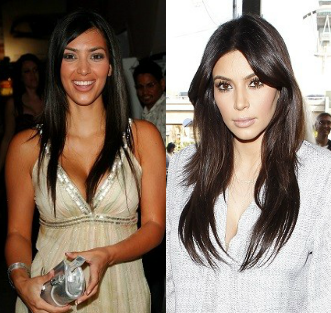 entretenimento | famosas | celebridades | plástica | antes e depois da plástica de algumas famosas | Lana de Rey | Megan Fox | Lindsay Lohan | Christina Aguilera