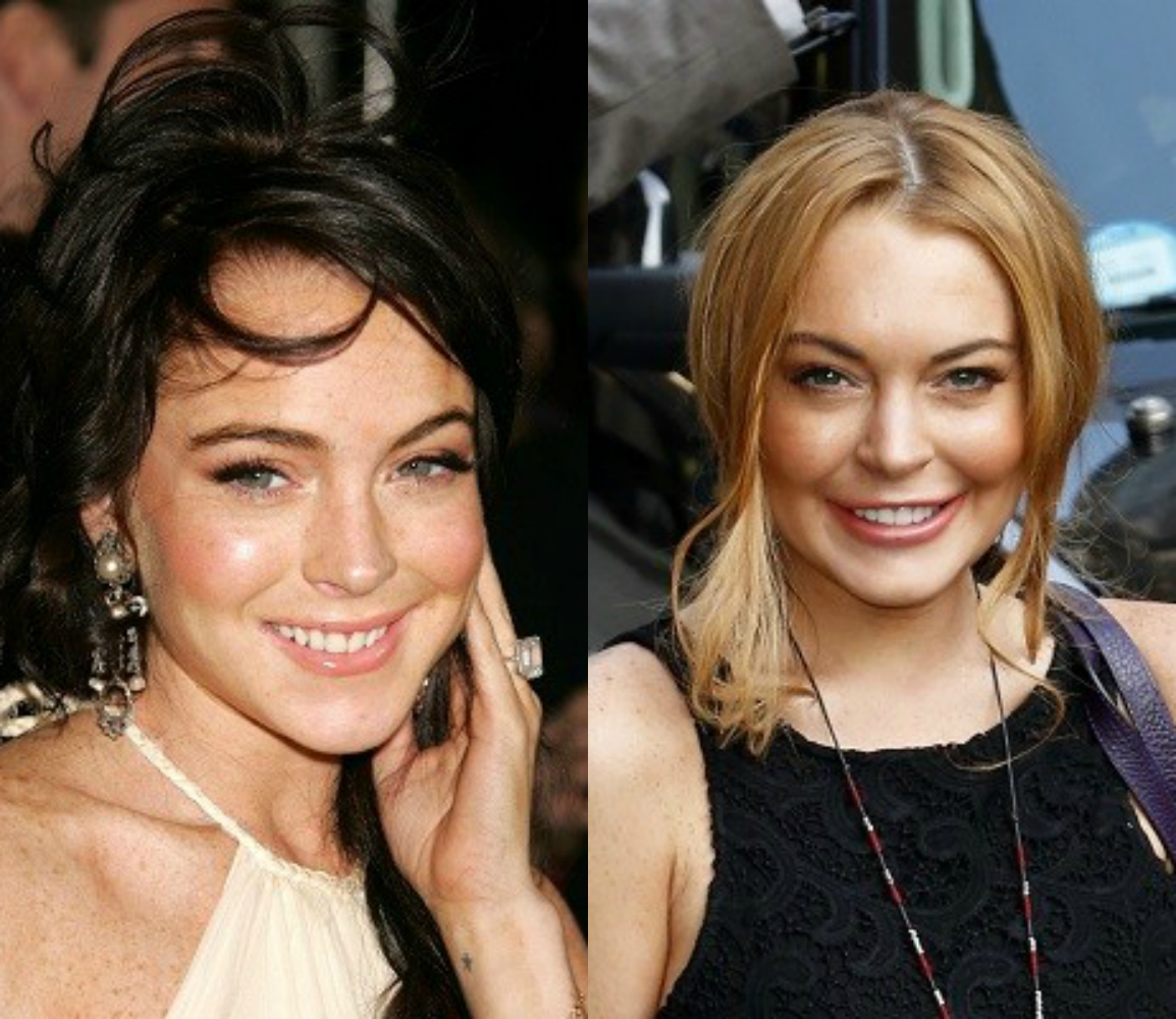 entretenimento | famosas | celebridades | plástica | antes e depois da plástica de algumas famosas | Lana de Rey | Megan Fox | Lindsay Lohan | Christina Aguilera