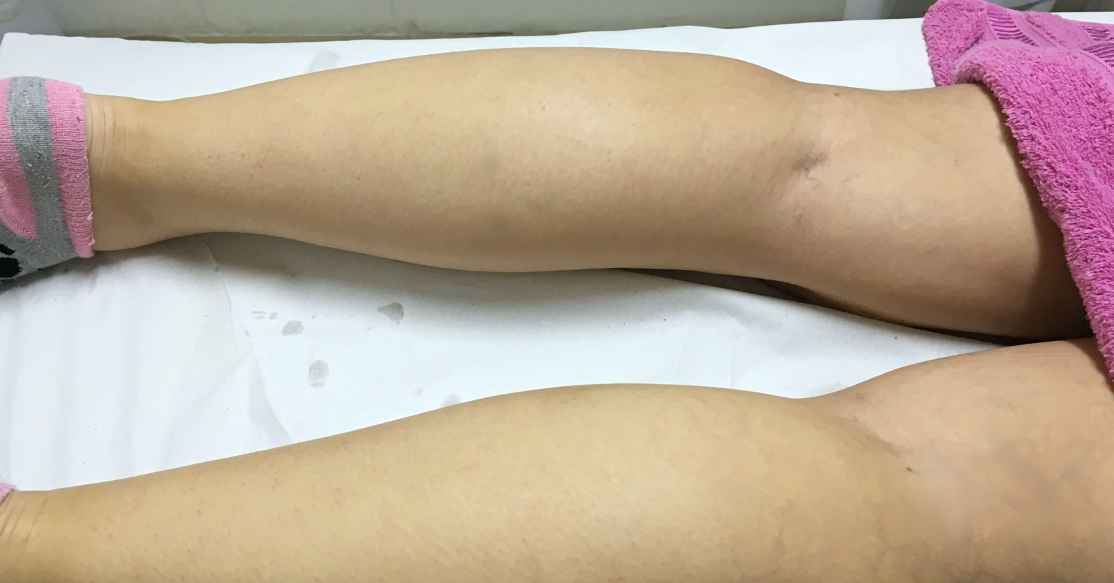 beleza | depilação a laser | depilação | depilação a laser preço | depilação a laser | depilação a laser meia perna | depilação a laser axila